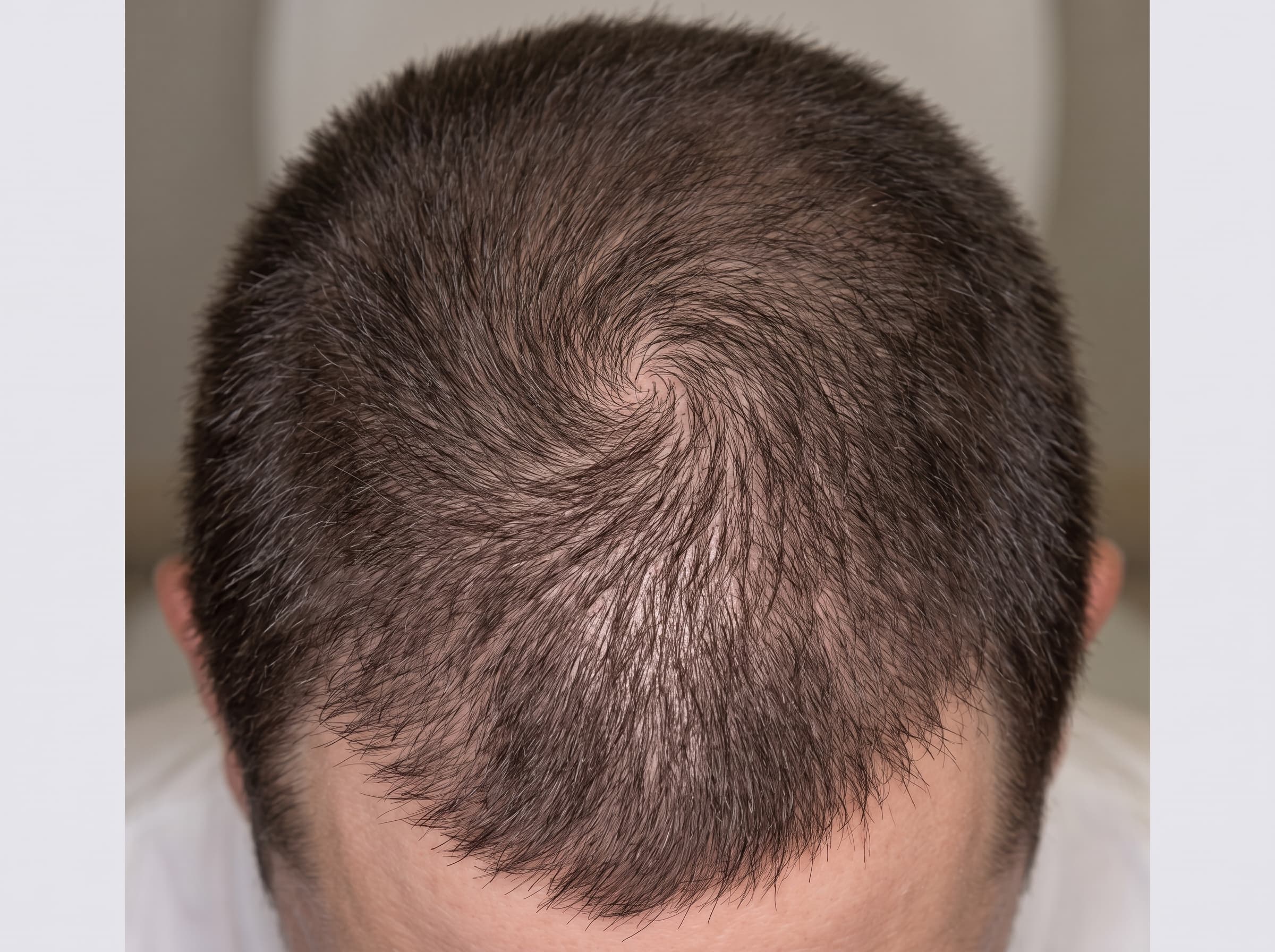 The same crown six months later under matched conditions